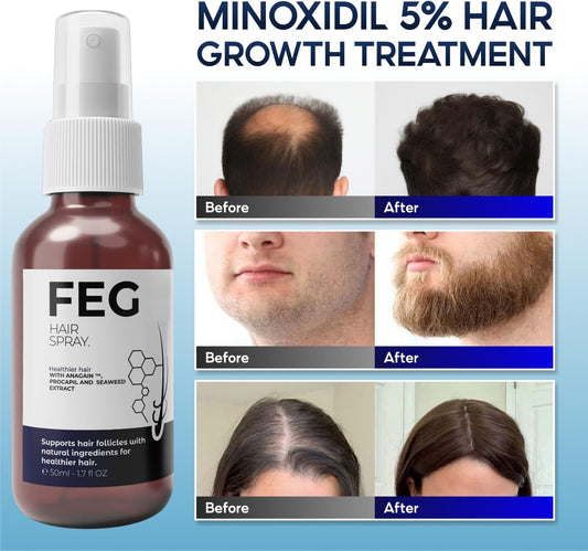 FEG Minoxidil Hair & Beard Growth Serum (50ml), Seaweed & Rosemary Extract Water, Minoxidil 5% Hair Growth Treatment for Men, Rosemary Oil for Hair Growth Booster, Thicker and Stronger Hair Spray