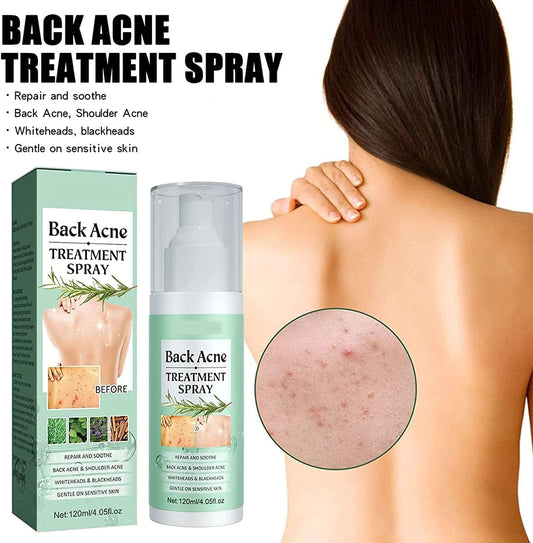 Back Acny spray