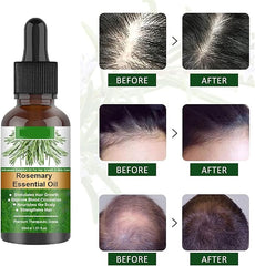 EELHOE 30ml Rosemary Hair Growth Essential Oil Prevent Hair Loss Nourish Scalp Strengthen Hair